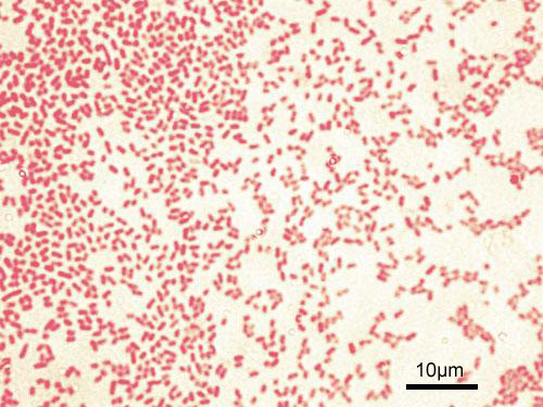 Pseudomonas-aeruginosa under the microscope