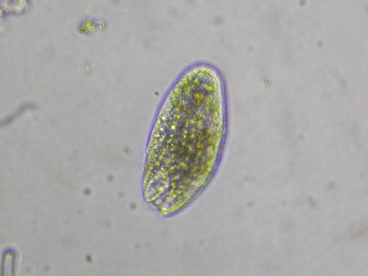 protozoa