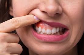 swollen gum 