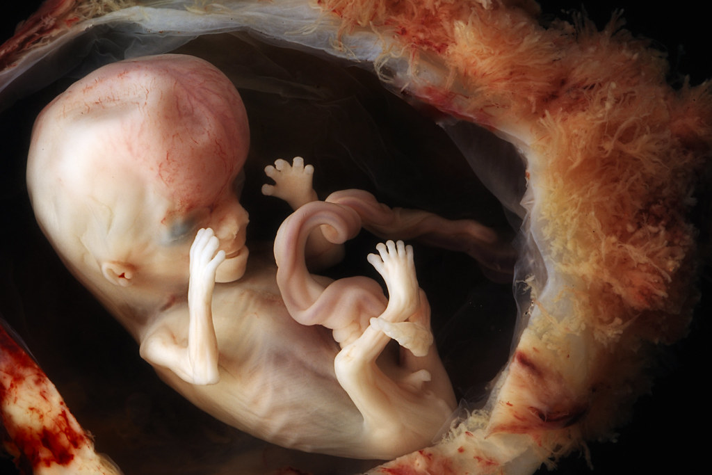 fetus in vitro