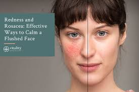 skin flushing