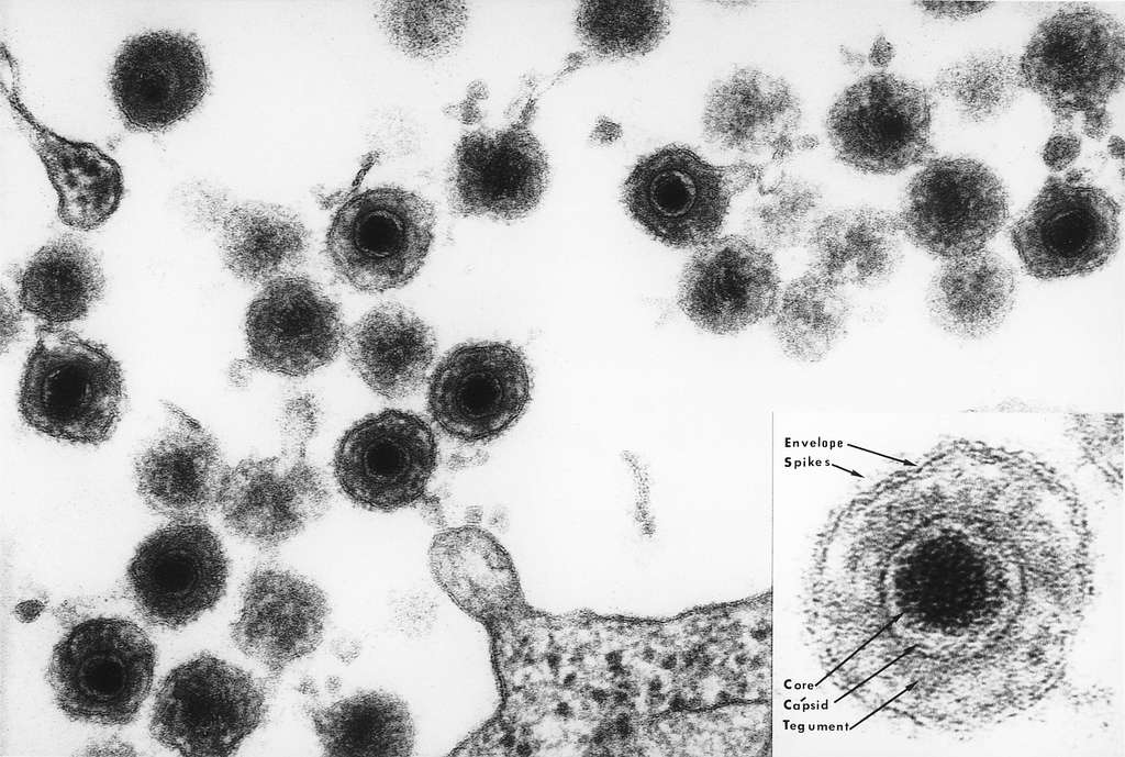 HH6 virus