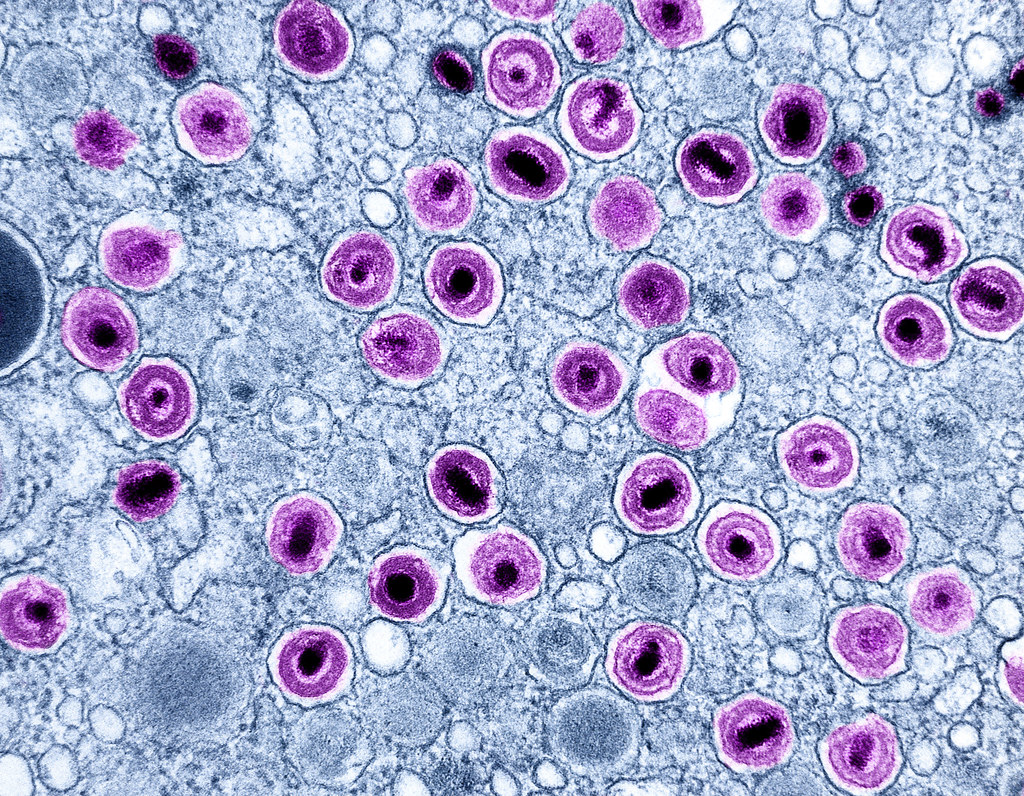 cytomegalovirus (CMV)