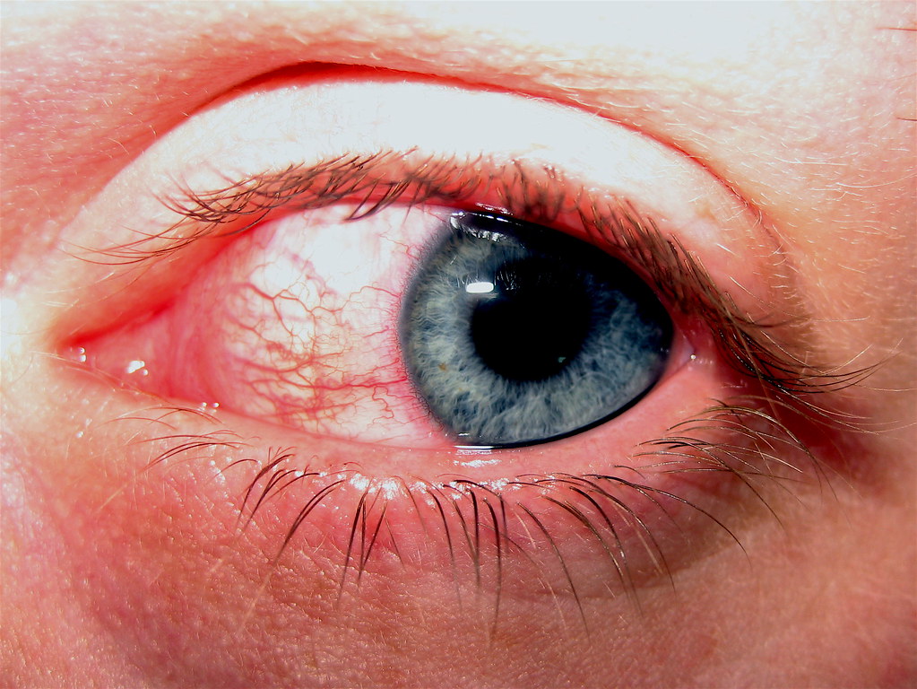 red eyes of woman
