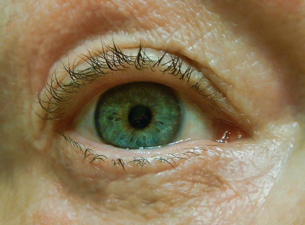 eyes of the elderly