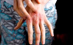 skin scratching
