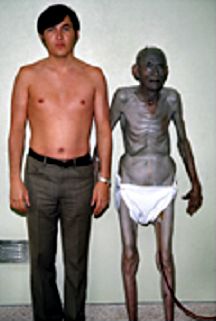 silver poisoning turning man blue