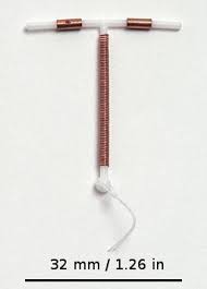 copper IUD