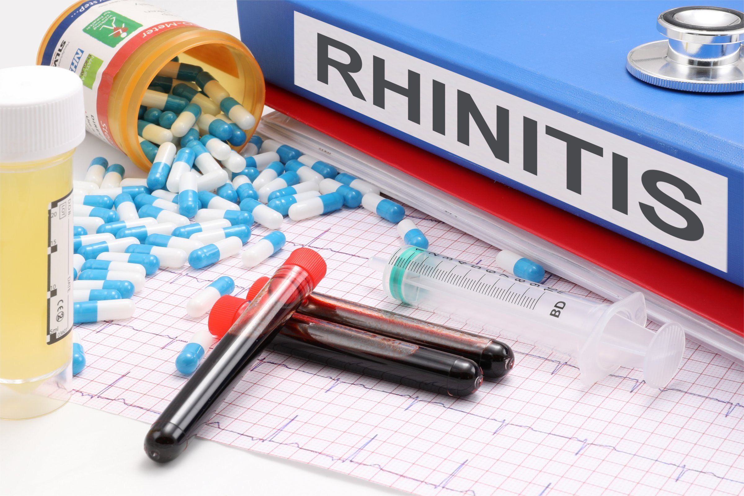 rhinitis