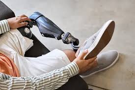 man sitting with prosthetic leg on the knee