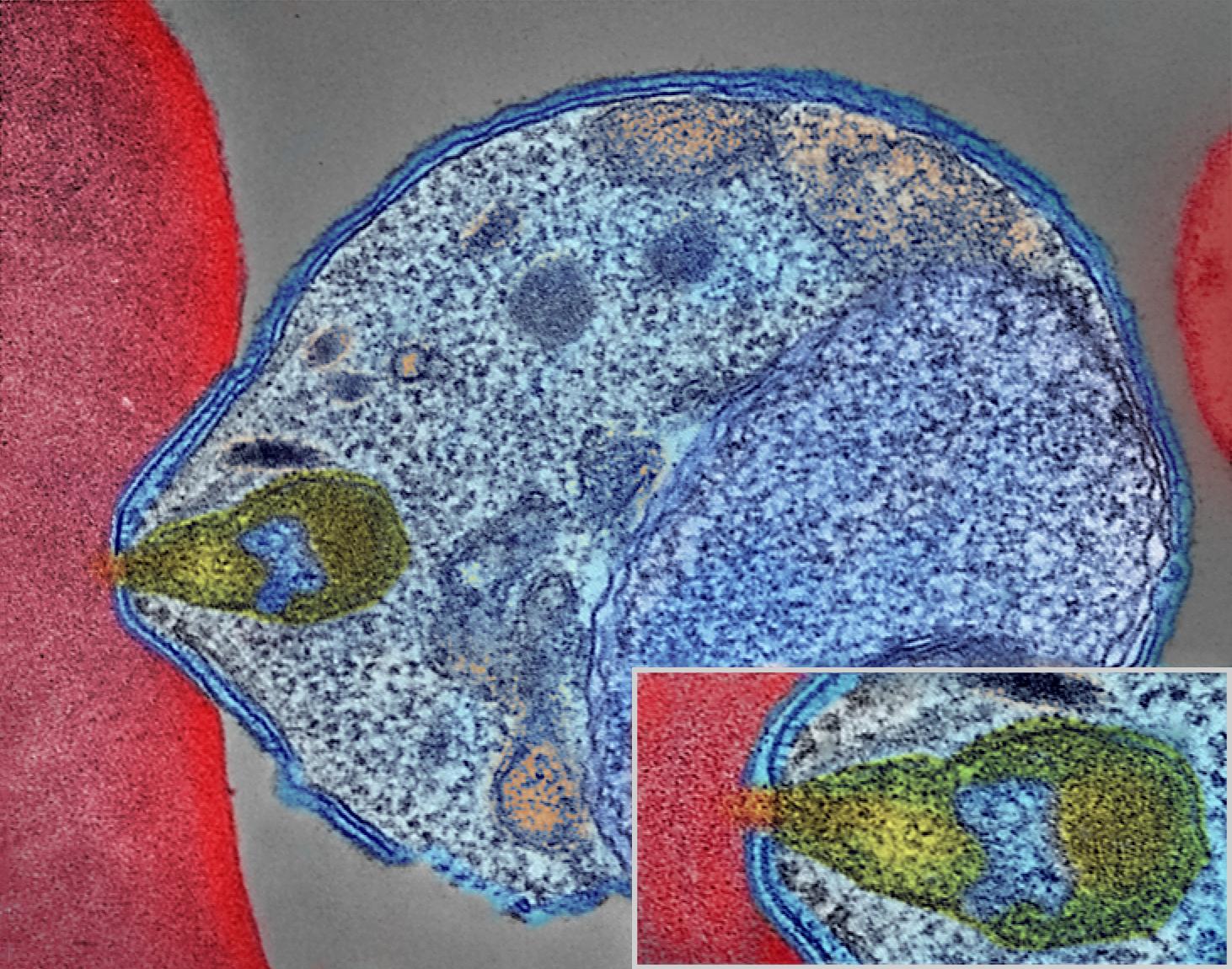 malaria parasite under the micriscope