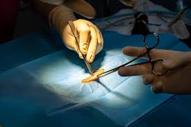 abdomen surgery