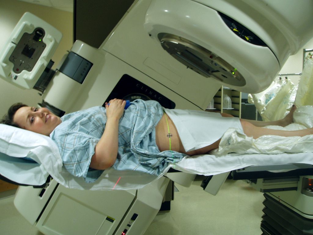 radiotherapy of pregnant women