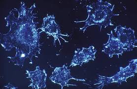 dividing cancer cells