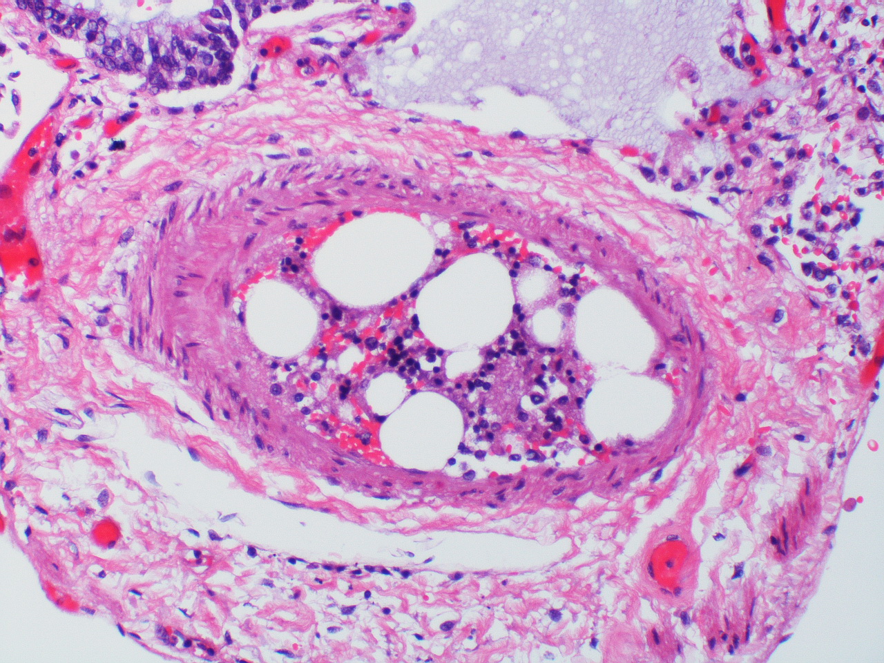 inside a bone marrow