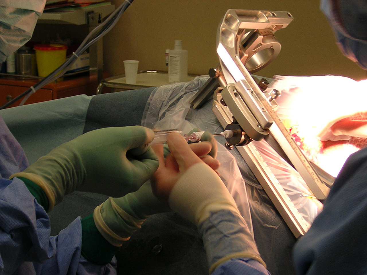 biopsy of the brain