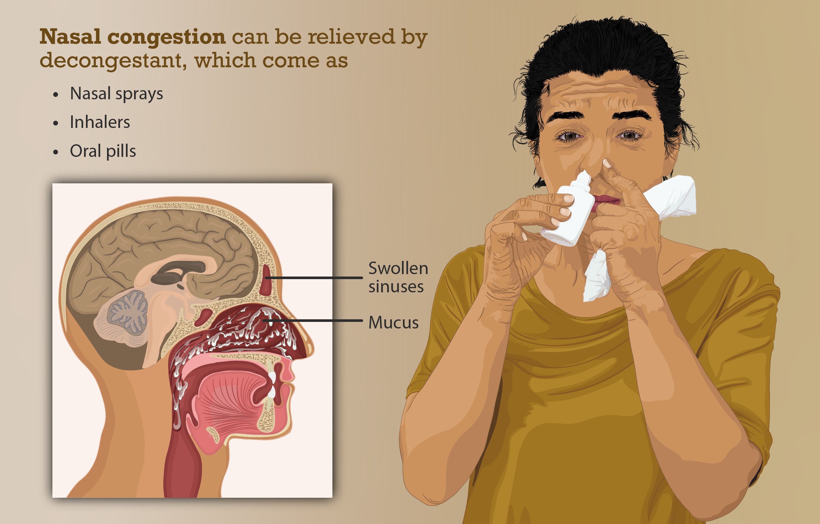 Nasal Congestion