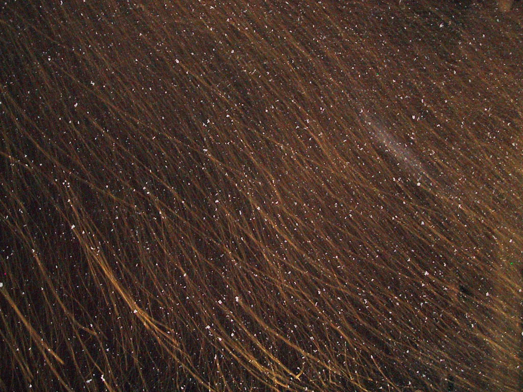 dandruff on scalp
