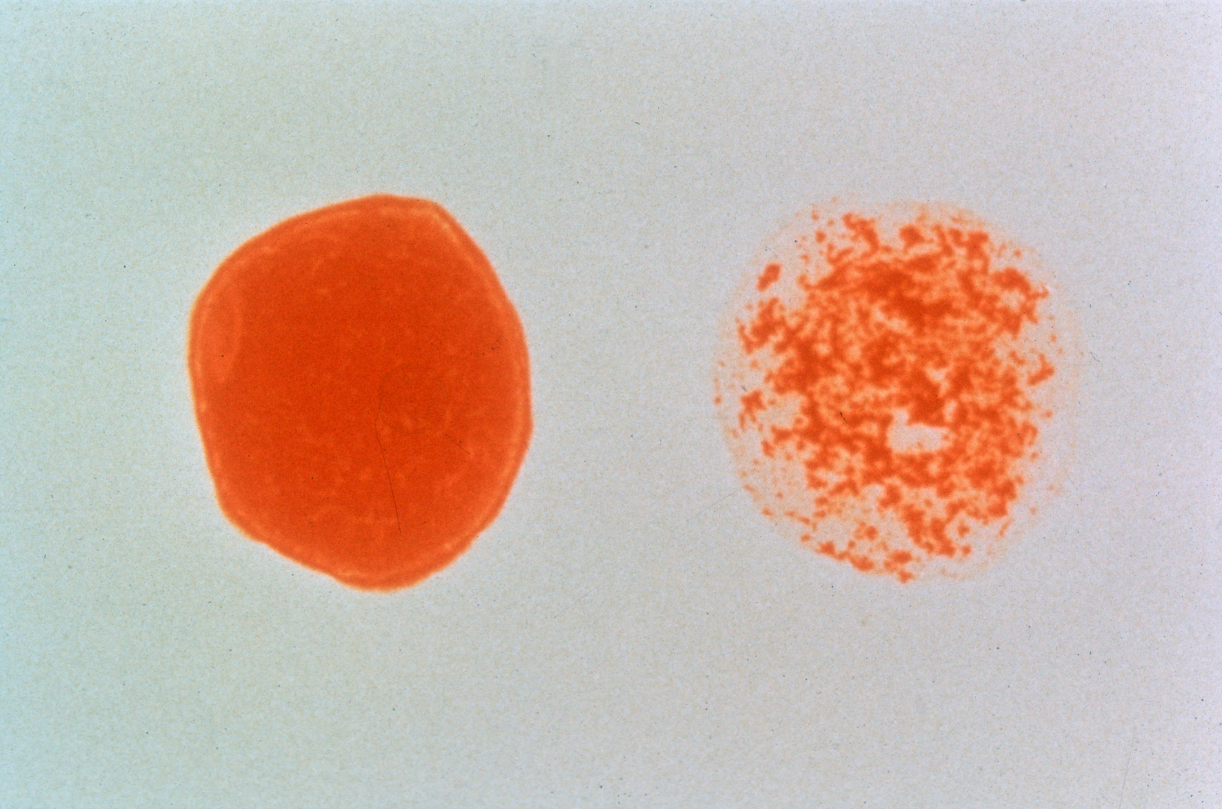 HIV positive and negative blood