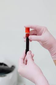 test tube with blood