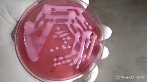 Klebsiella species