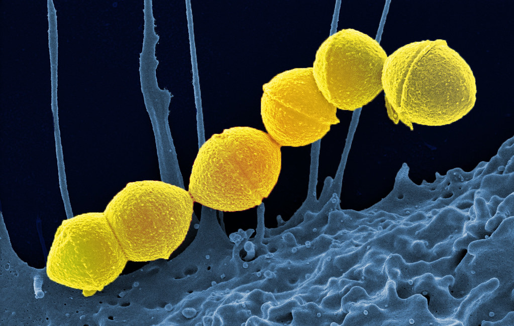 streptococcus bacteria
