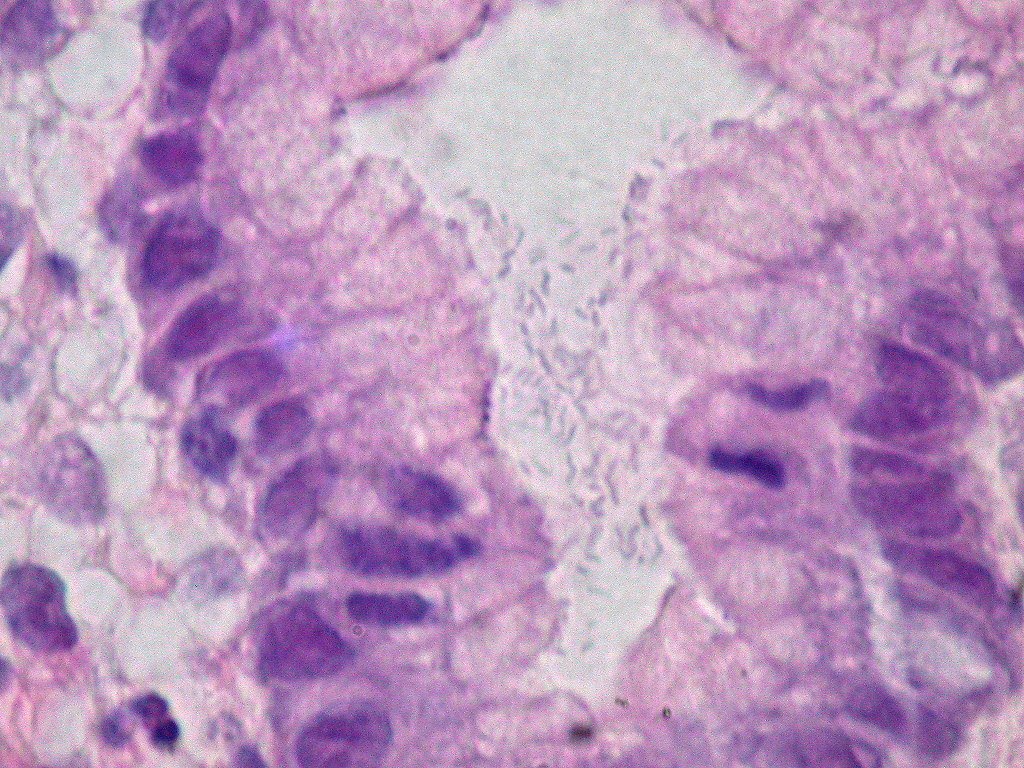 h pylori bacteria
