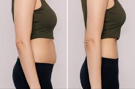 weight loss of woman on semaglutide