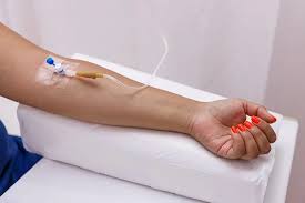 intravenous delivery 