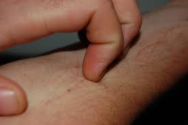 hand scratching itch