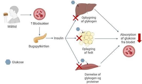 type 2 diabetes