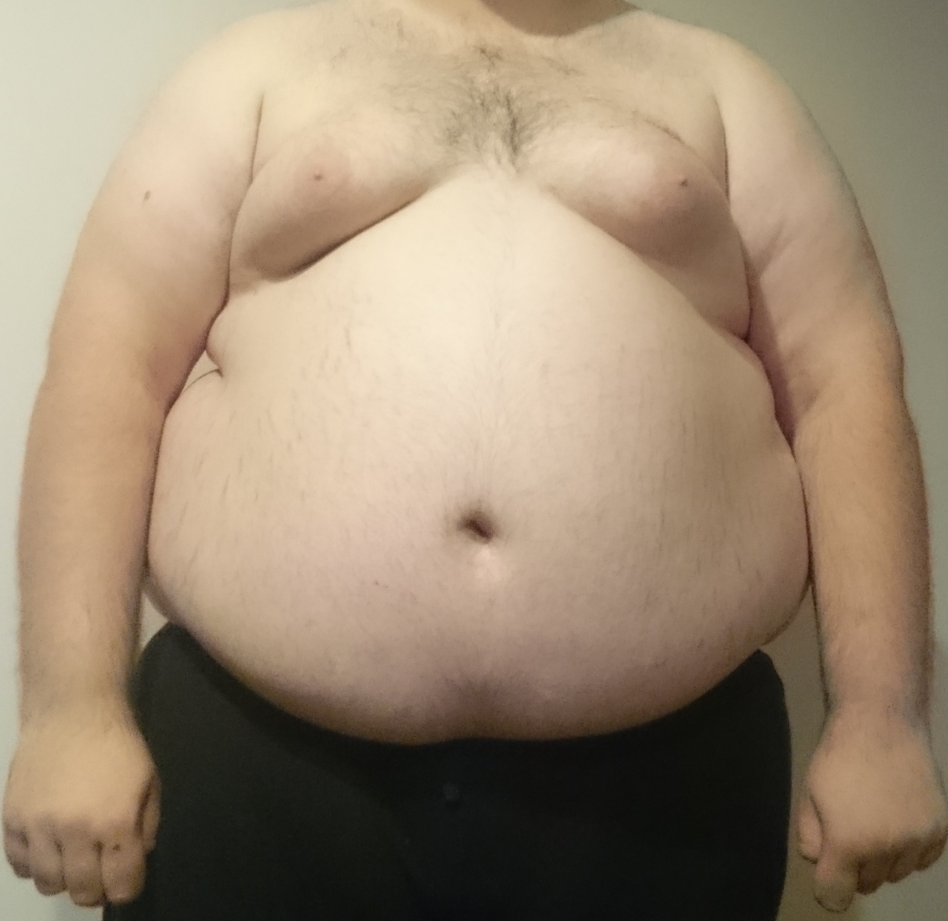 view of obese man