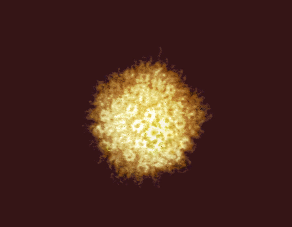 Herpes Simplex Virus Micrograph
