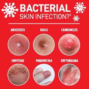 Skin Infection.