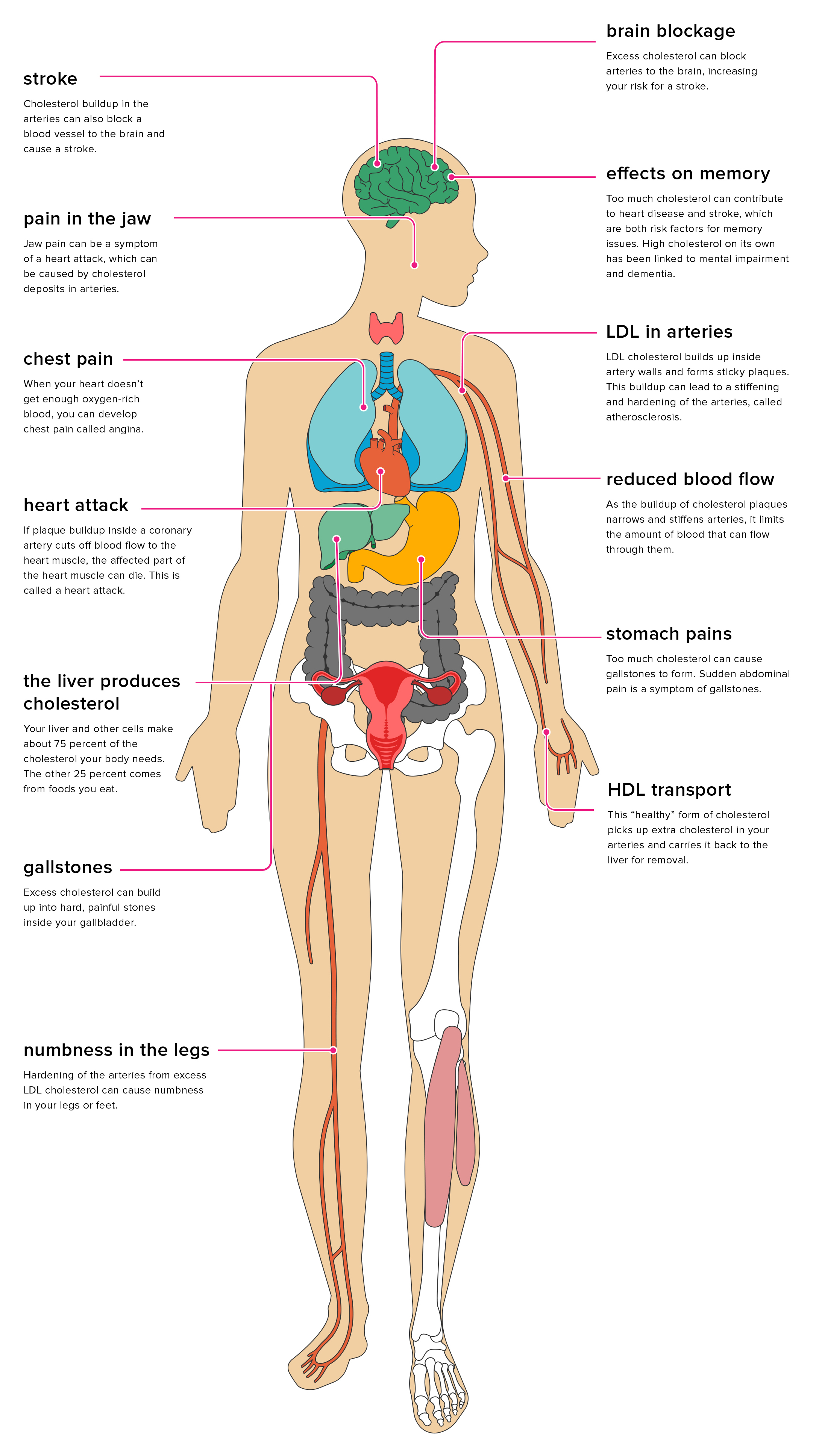 High Colhesterol side effects