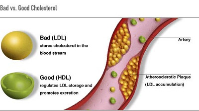 LDL and HDL