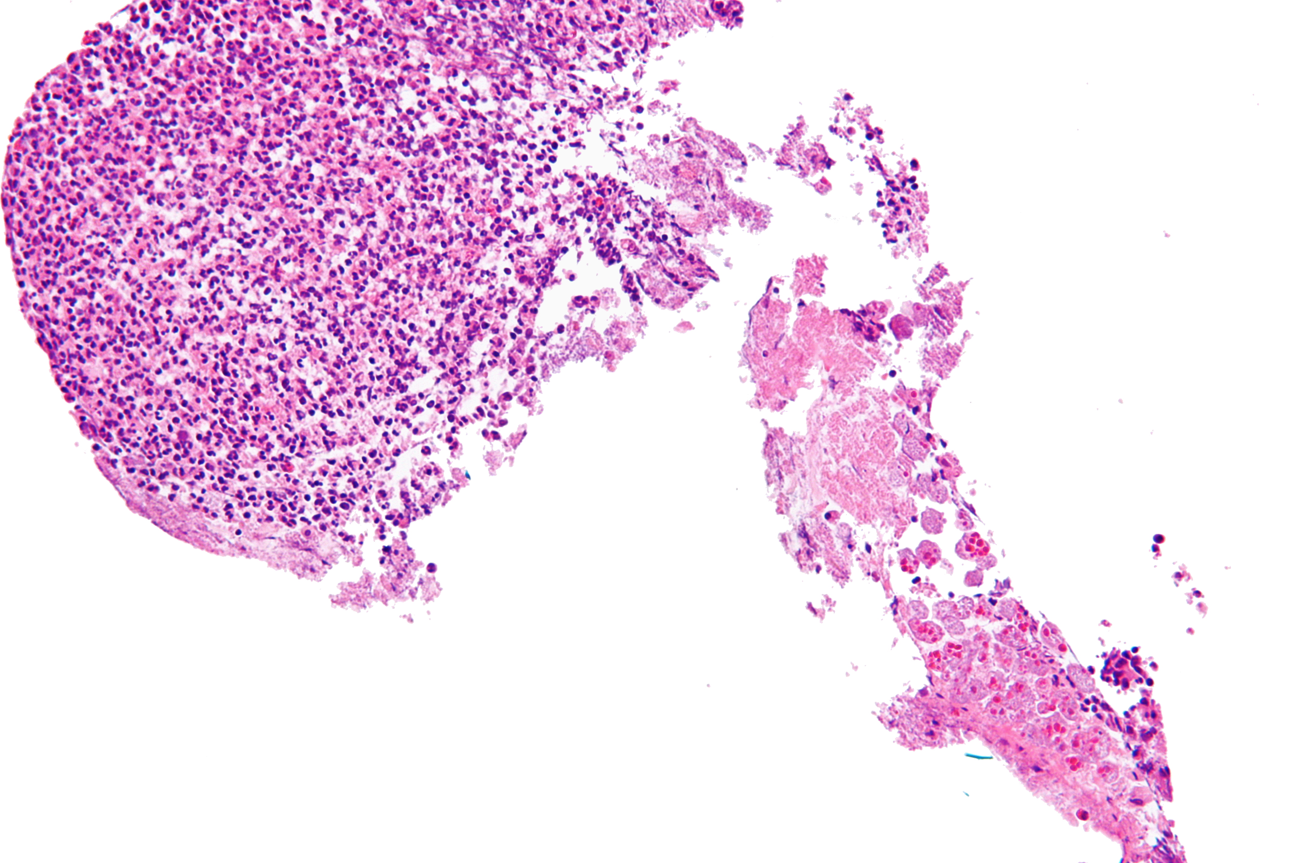 Amebiasis Under the Microscope 