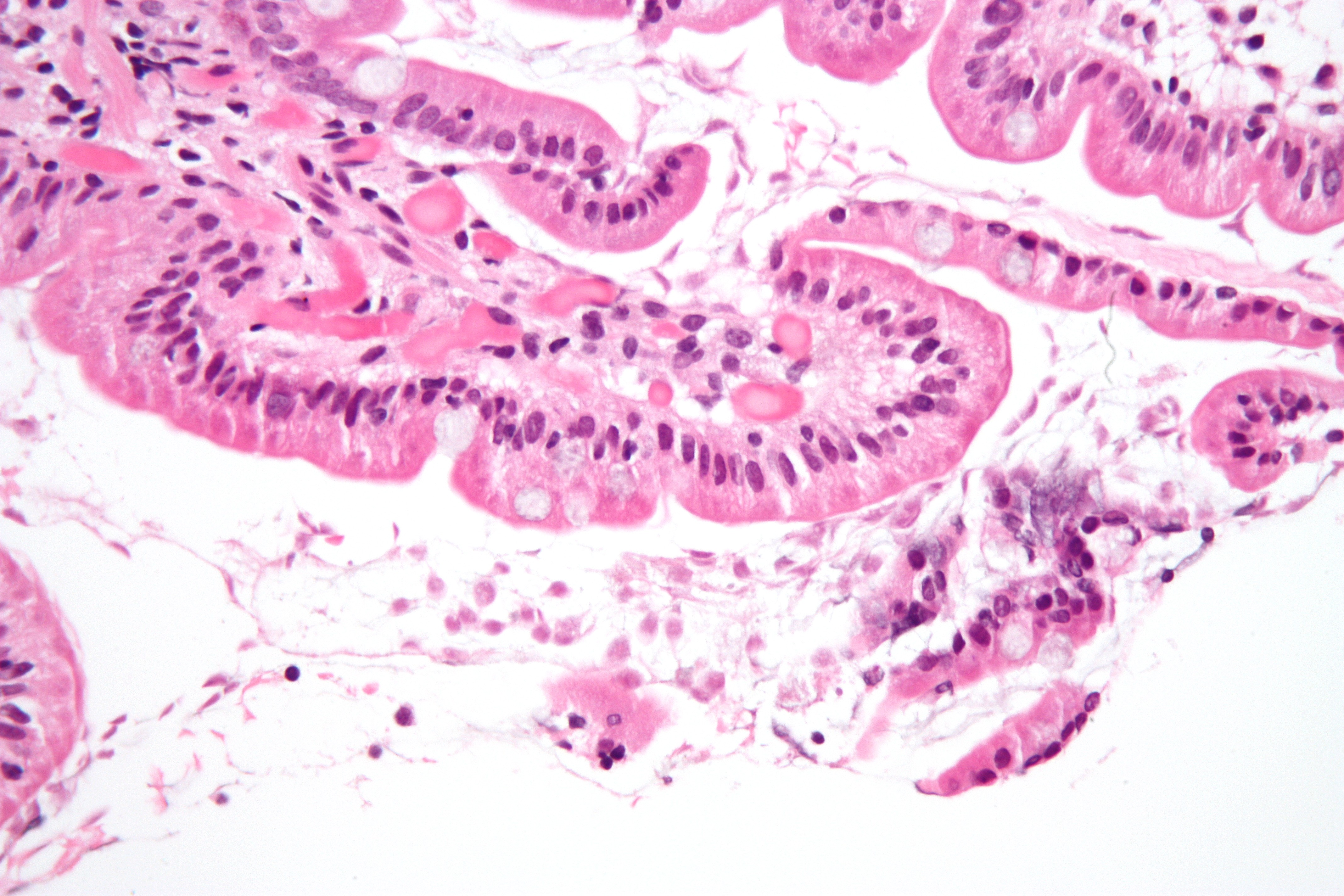 Giardiasis under the microscope