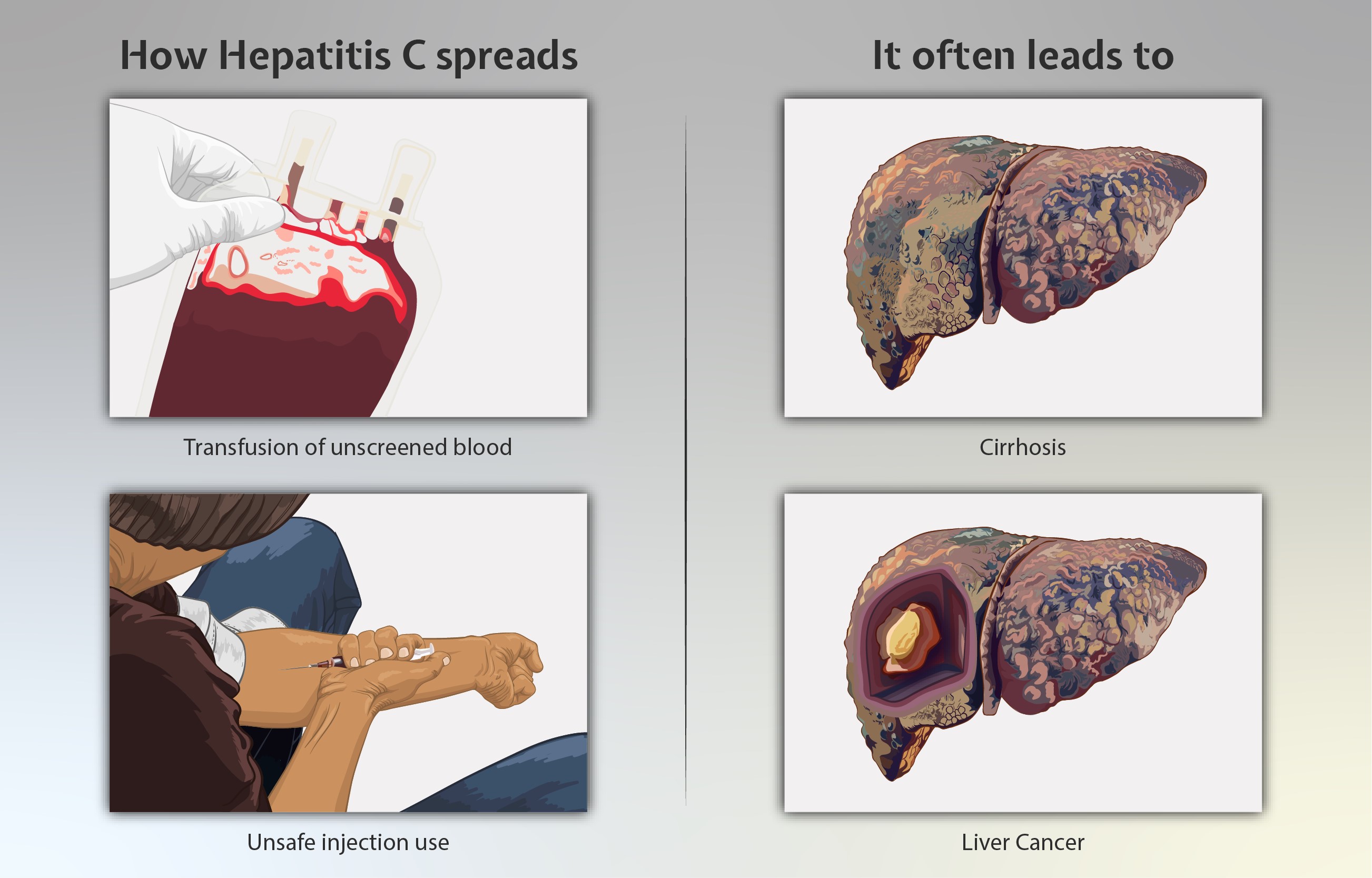 Spread of Hepatitis C