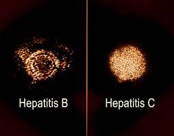 Hepatitis C virus under the microscipe
