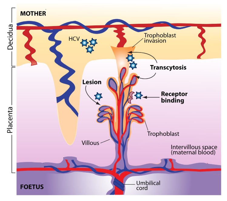 Hepatitis C during pregnancy