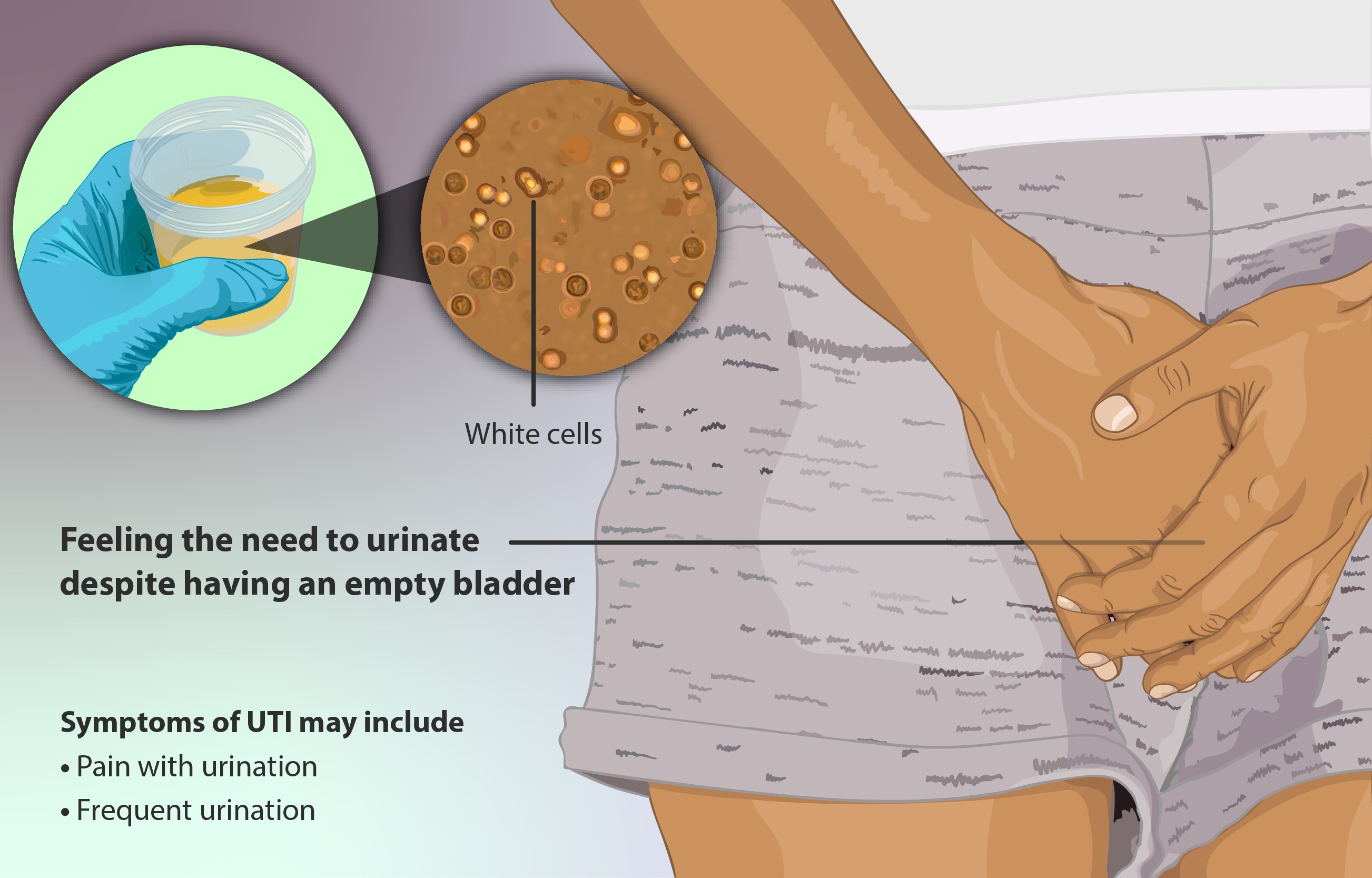 Urinary-tract-infections