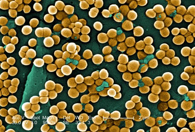Staphylococcus-aureus