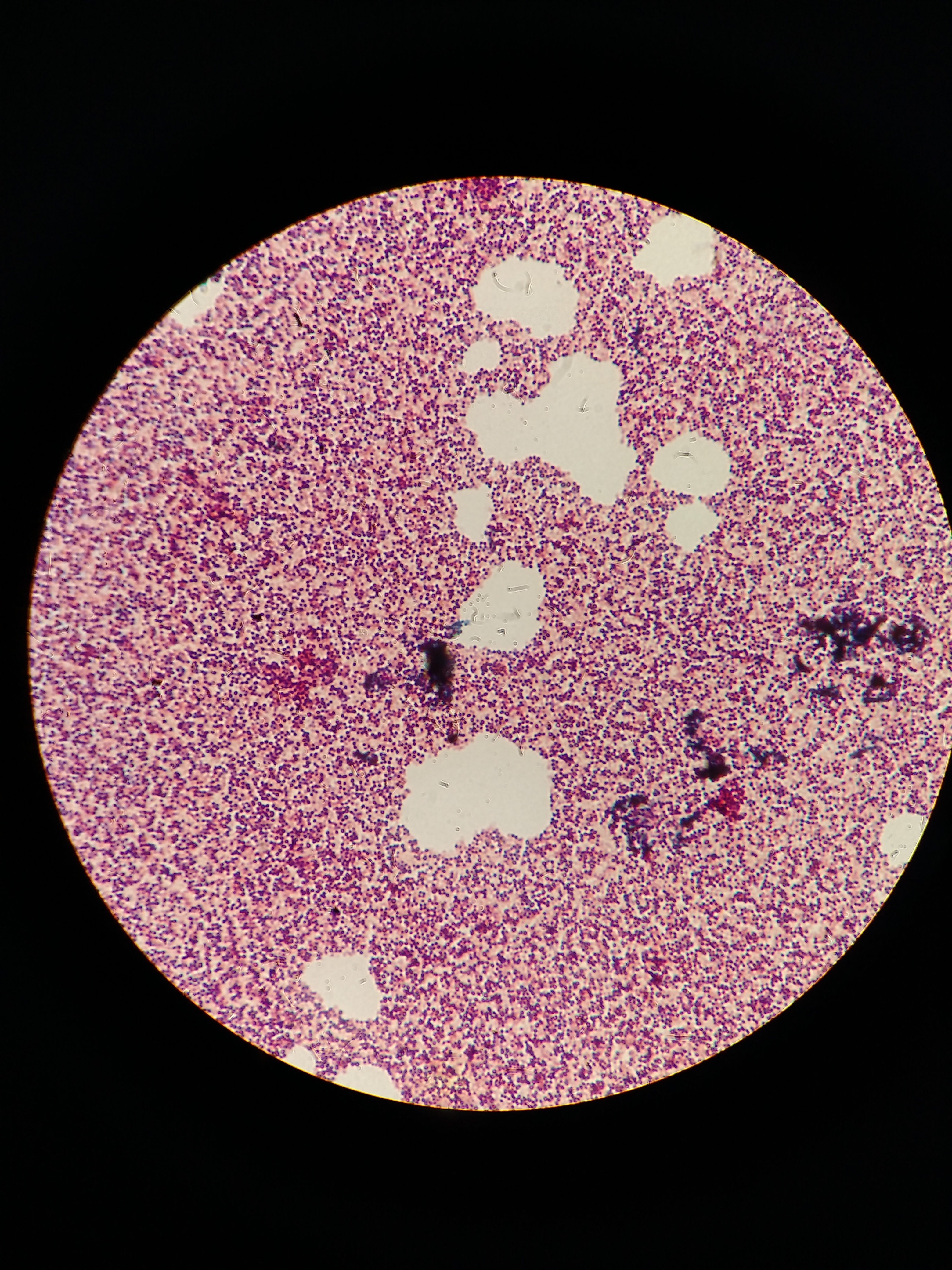 staphylococci