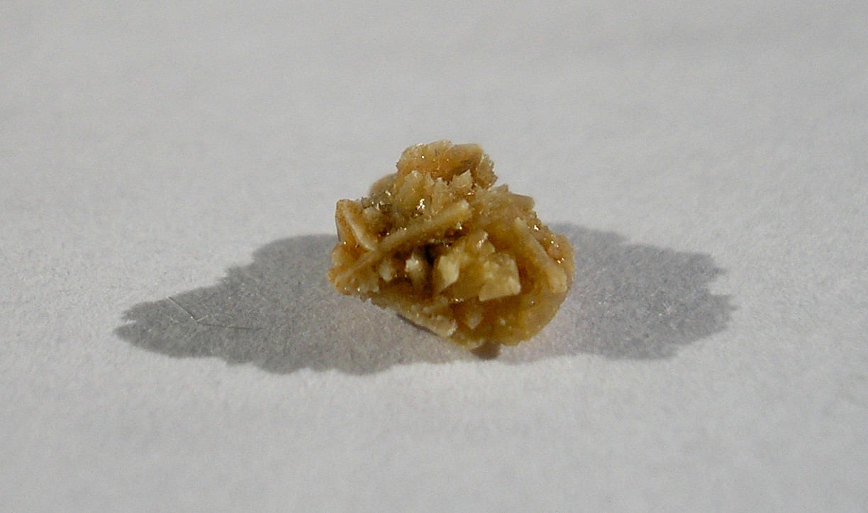 Kidney stone 