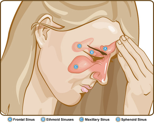 Sinuses