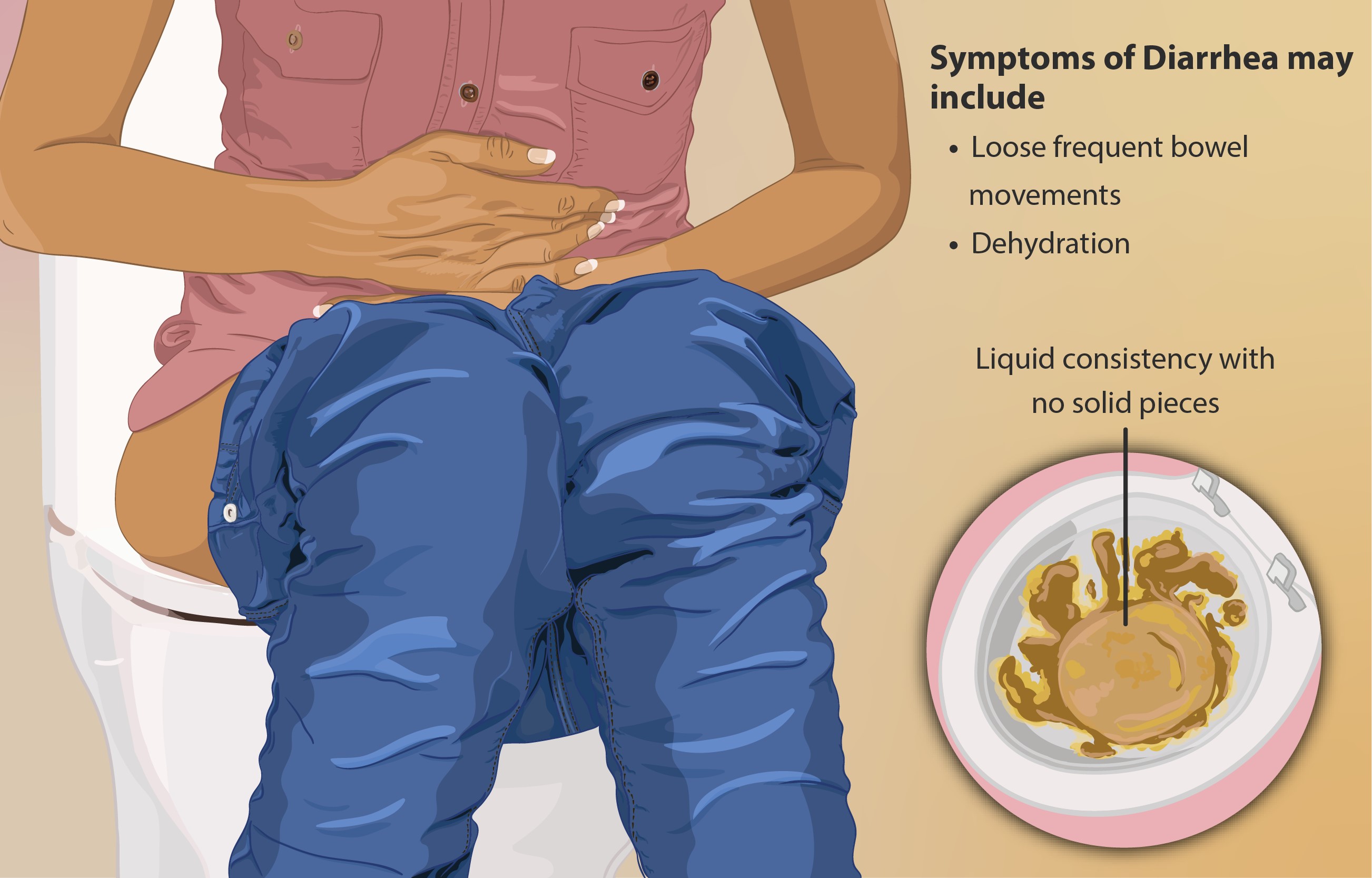 Diarrhea Symptoms