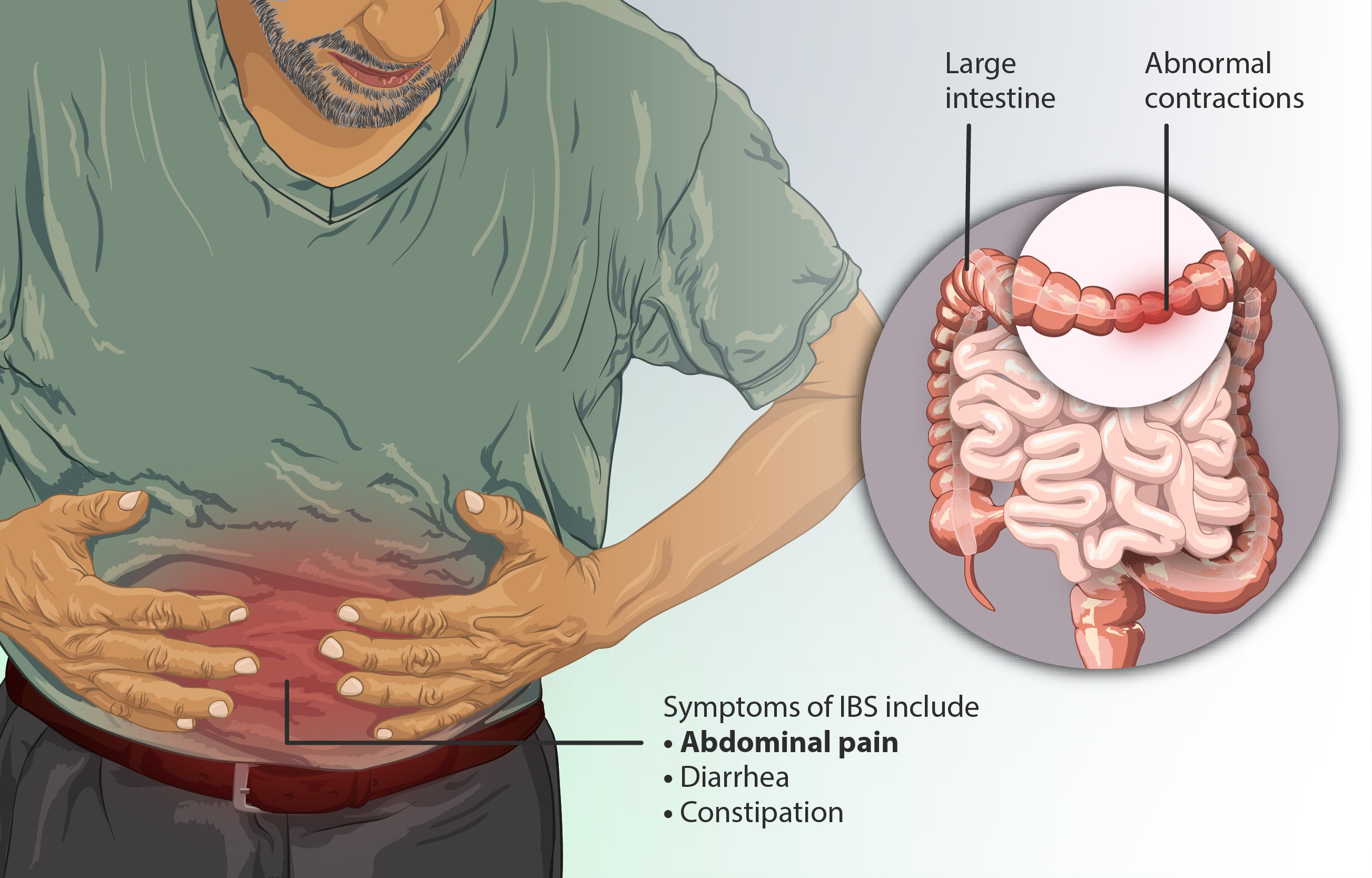 Symptoms of IBS