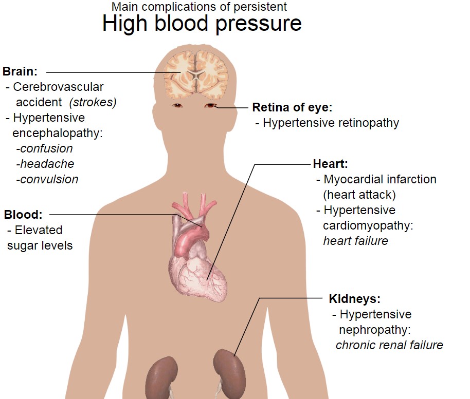 Hypertension Complications