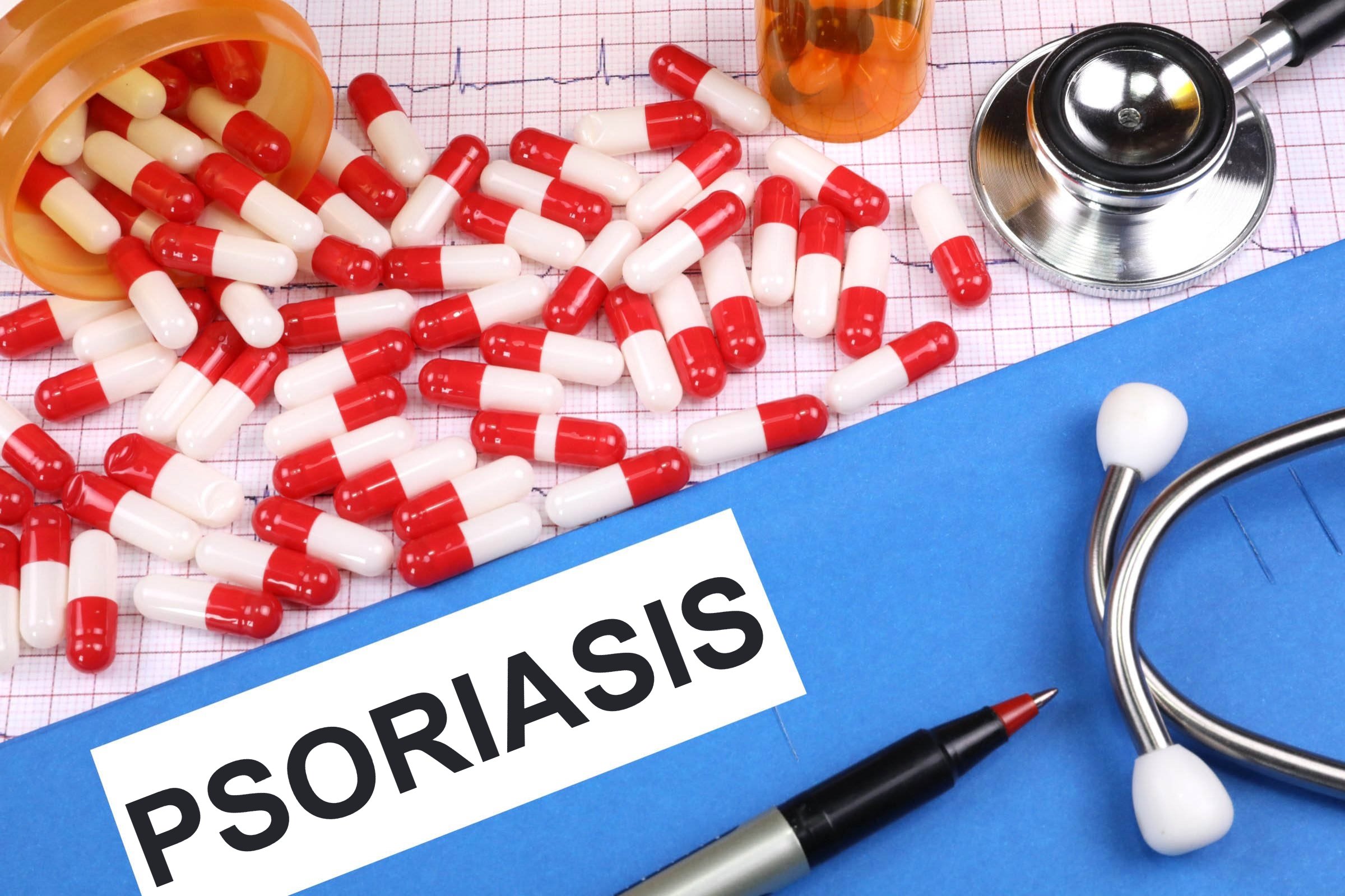 psoriasis